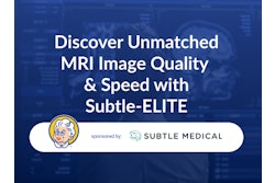 400x300 Subtle Medical Ame 250319