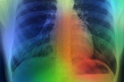 Artificial Intelligence Lung Color 400