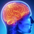 Brain General Thumbnail