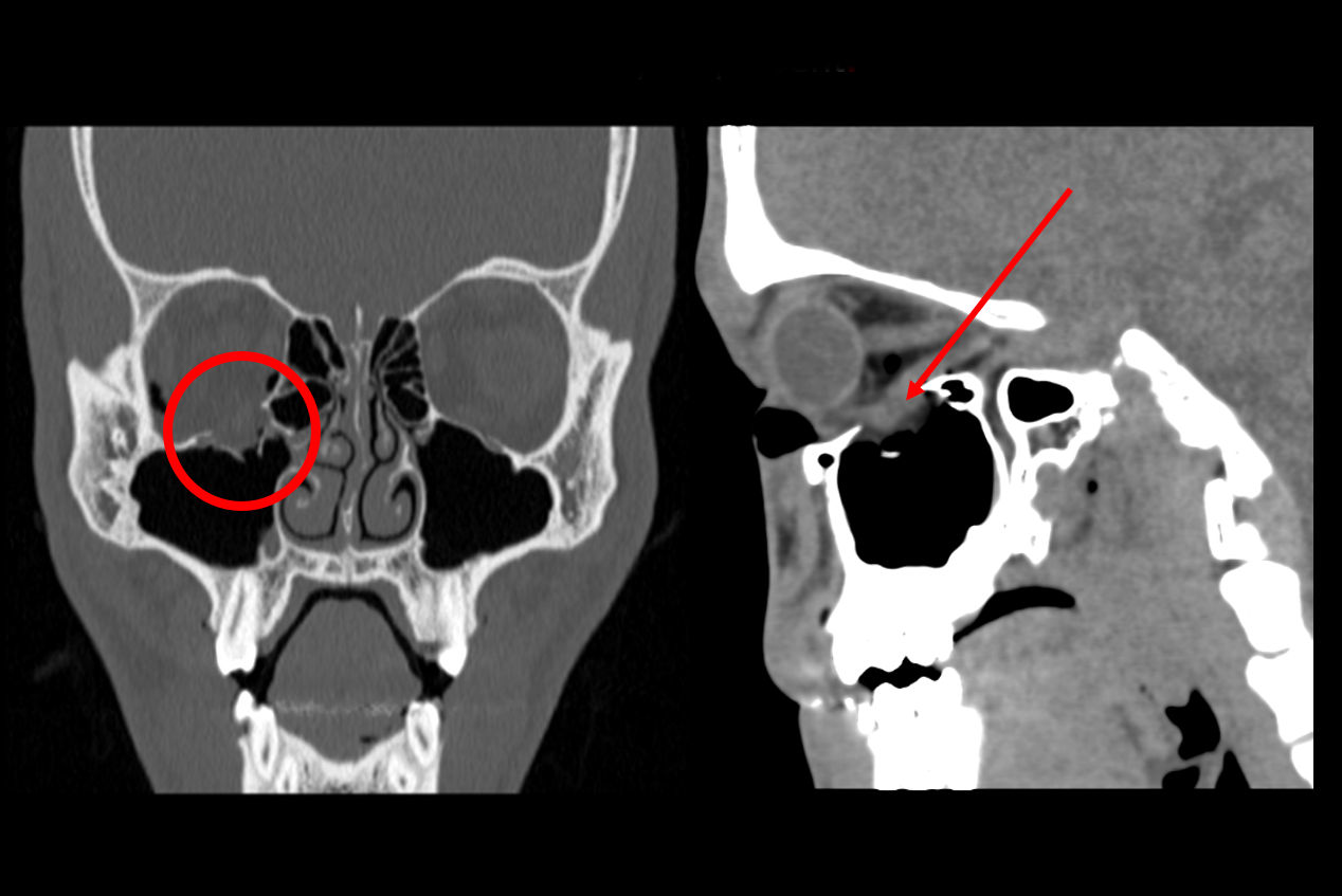 2025 04 14 Fig 2 Orbital Thumbnail