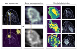 2025 04 15 Radiology Mri Nomogram Thumbnail