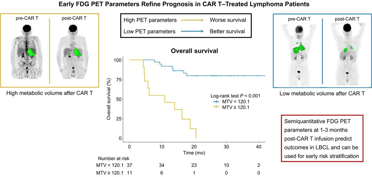 PET scans predict outcomes for patients undergoing CAR T-cell therapy ...