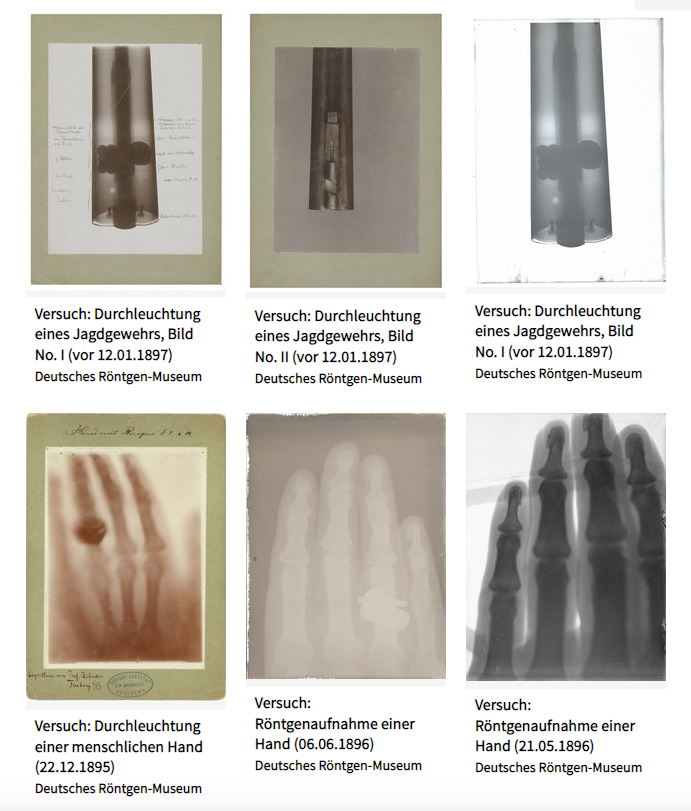 Six historic x-ray images from the estate of Wilhelm Conrad R&ouml;ntgen. Image courtesy of Rheinland Museum Digital, UNESCO Memory of the World.
