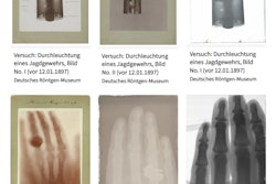 Six historic x-ray images from the estate of Wilhelm Conrad Röntgen. Image courtesy of Rheinland Museum Digital, UNESCO Memory of the World.