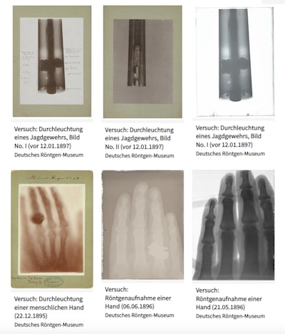 Six historic x-ray images from the estate of Wilhelm Conrad Röntgen. Image courtesy of Rheinland Museum Digital, UNESCO Memory of the World.