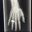 Space X Ray1 Thumbnail