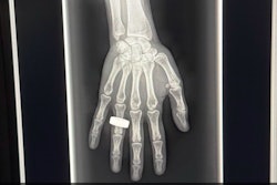 Space X Ray1 Thumbnail