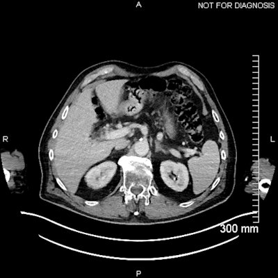 2025 04 24 Mol Insider Figure 6