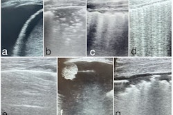 2025 04 22 Emergencyrad Surveillance Imaging Evar 1l A7 Sm2a98