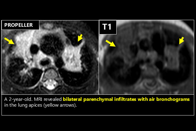 2025 05 01 Mri Insider Figure 1 Thumbnail