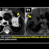 2025 05 01 Mri Insider Figure 1 Thumbnail
