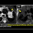 2025 05 01 Mri Insider Figure 1 Thumbnail
