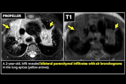 2025 05 01 Mri Insider Figure 1 Thumbnail