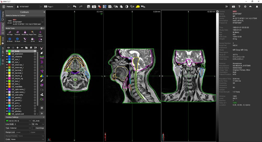 GEHC to feature expanded portfolio, updates at ESTRO 2025 ...