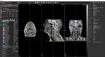 GEHC MR Contour DL images. Courtesy GE HealthCare.
