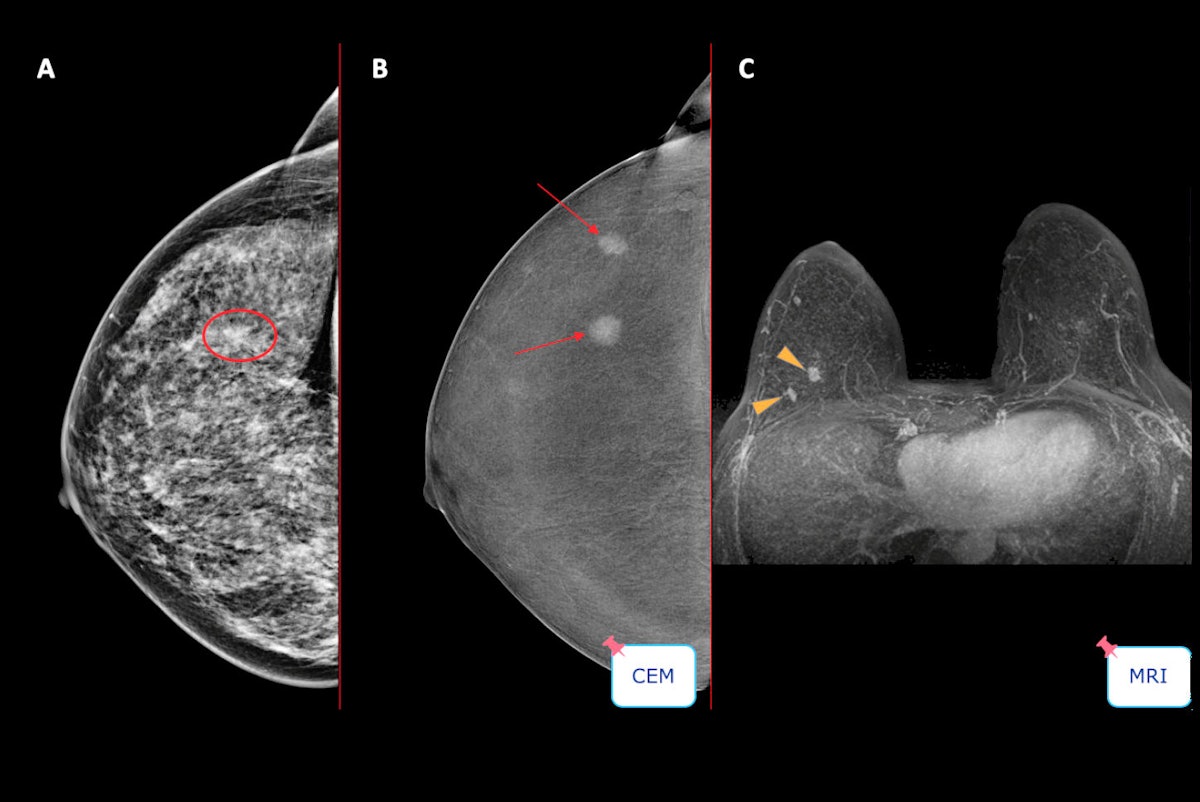 Spanish group spells out pros and cons of CEM | AuntMinnieEurope