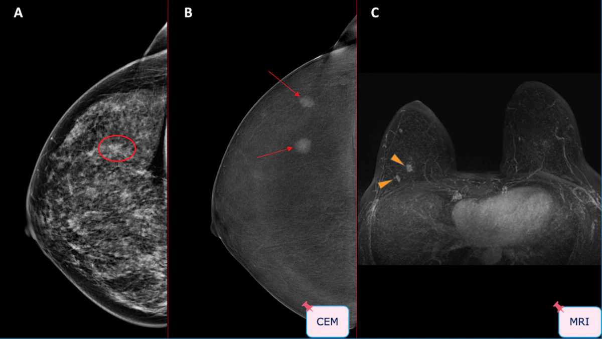 Spanish group spells out pros and cons of CEM | AuntMinnieEurope
