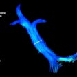 4d Flow Mri Portal Vein oz Gnp Np620