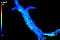 4d Flow Mri Portal Vein oz Gnp Np620