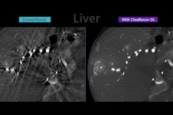 Clearecondl Clinic Thumbnailv2 1106x622 2 p85 Zs4 Gvce