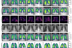 Frontal Chest Radiographs 101148 Ryai240484 m Cnnc B Bfx I