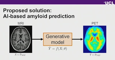 AI models can generate synthetic equivalents to PET images from routinely acquired T1W MRI scans.