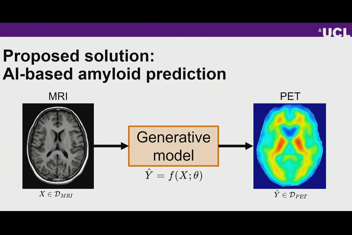 Mri To Pet toa4 Wkoet J Thumbnail