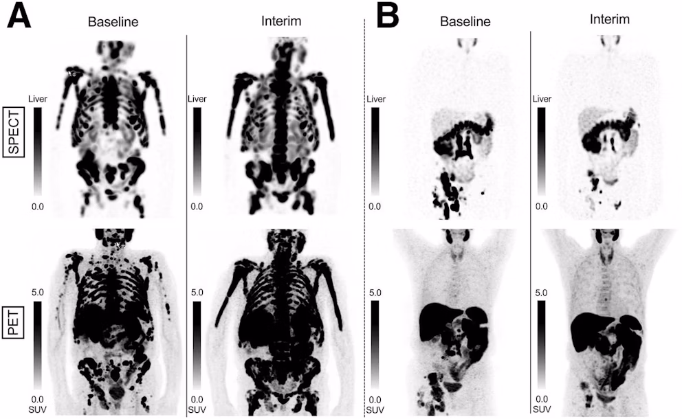 Pluvicto Responses p Sj6gw Ij9 D