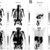 Pluvicto Responses p Sj6gw Ij9 D