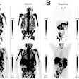 Pluvicto Responses p Sj6gw Ij9 D