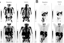 Pluvicto Responses p Sj6gw Ij9 D
