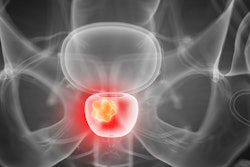 Prostate 3 D