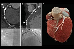 2025 05 29 Rad Cardiothoracic Van Der Bie Figure3 Thumbnail