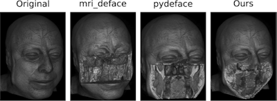 Comparison of the defacing results of different defacing algorithms. While the result of pydeface and the proposed algorithm are similar, pydeface additionally cuts off the shoulder region of the scan, while taking 260 times longer on average than the proposed algorithm. The face shown is from the publicly available Synthstrip dataset.