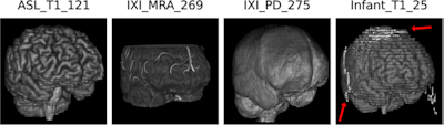 Skull-stripping results of the proposed algorithm. Shown are examples from the Synthstrip test dataset, including T1, magnetic resonance angiography (MRA), proton density (PD) and infant T1 scans. The proposed methods produce sound results, but might struggle with parts of infant brains.