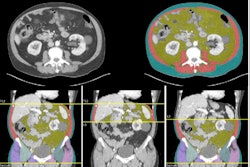 Examples of CT volumetric and single-slice images produced by Data Analysis Facilitation Suite (DAFS) v3.9 software are displayed.