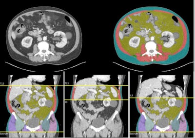 Examples of CT volumetric and single-slice images produced by Data Analysis Facilitation Suite (DAFS) v3.9 software are displayed.