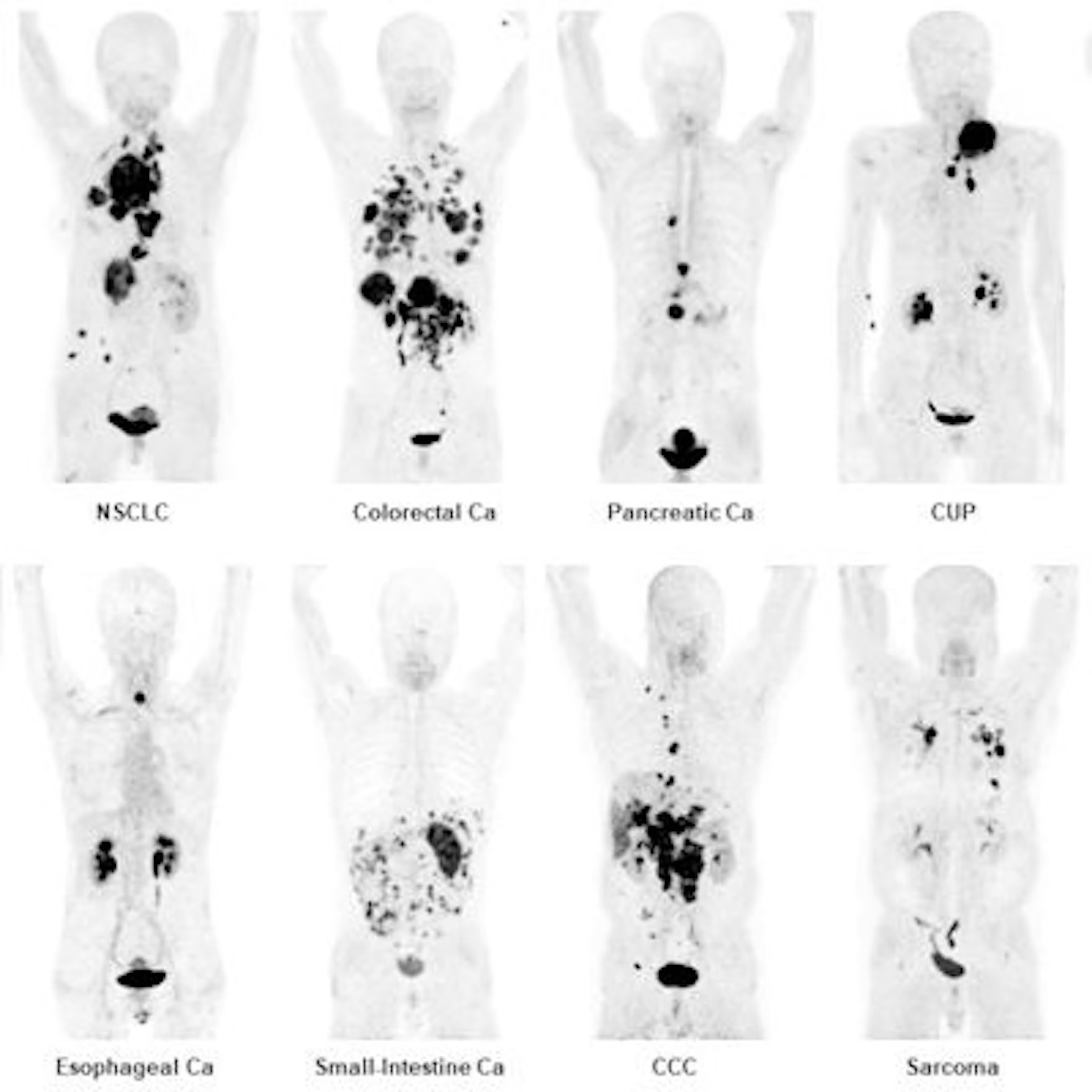 Fap Theranostics w Ue25ija Ys