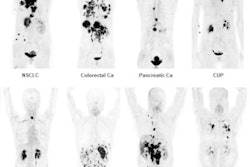 Fap Theranostics w Ue25ija Ys