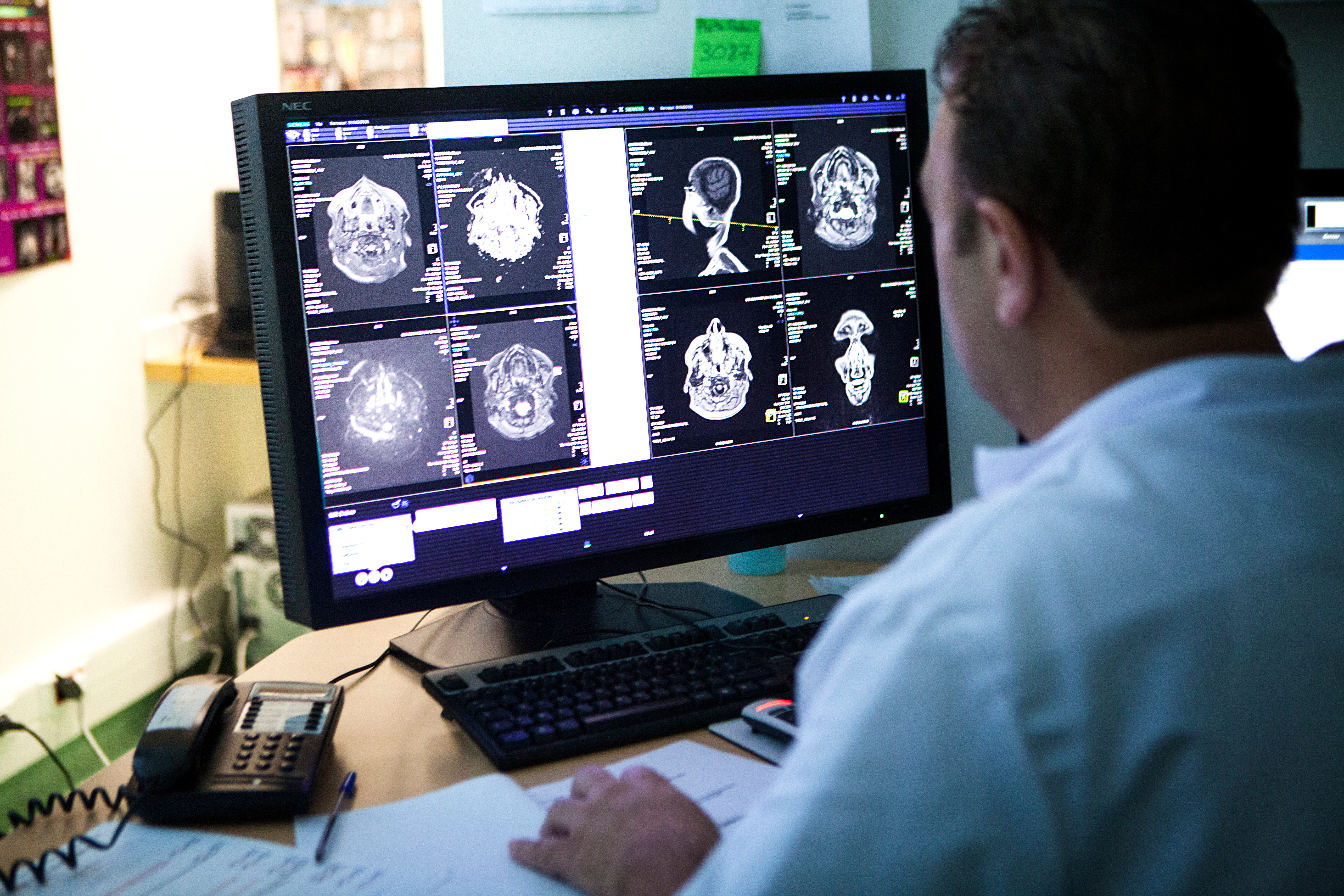 Radiologist Brain Scans Monitor