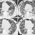 2025 07 22 Larici Figure3 Thumbnail