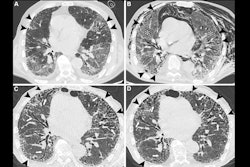 2025 07 22 Larici Figure3 Thumbnail