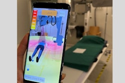 2025 07 24 Digital X Ray Insider Figure 1 Thumbnail