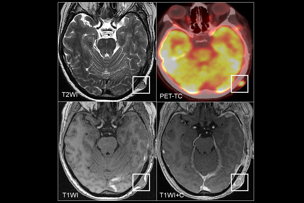 2025 07 31 Mri Insider Figure19 Thumbnail