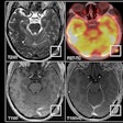 2025 07 31 Mri Insider Figure19 Thumbnail