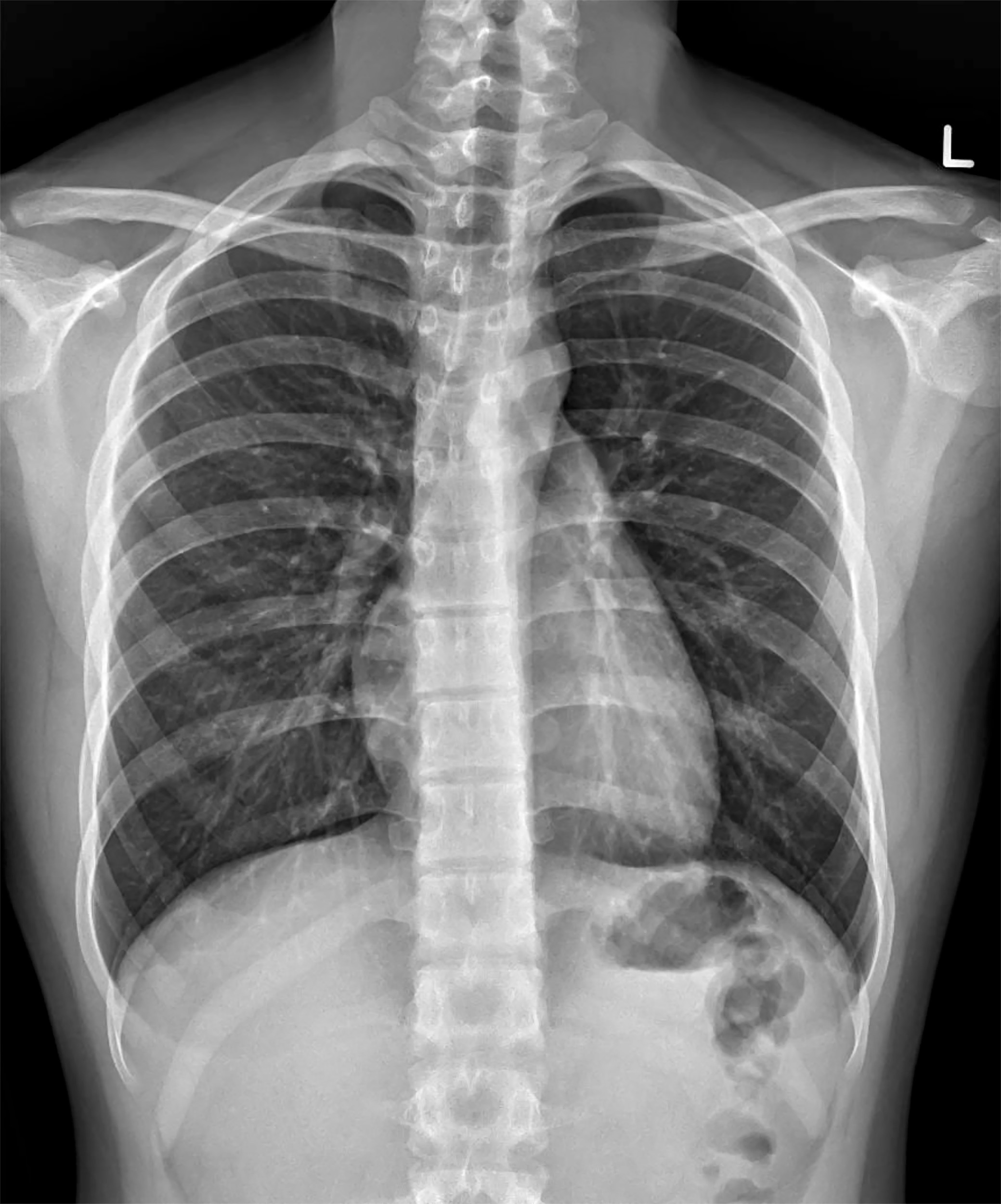 Chest X Ray Adobestock Issara