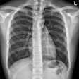 Chest X Ray Adobestock Issara