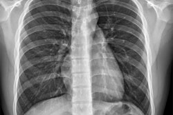 Chest X Ray Adobestock Issara