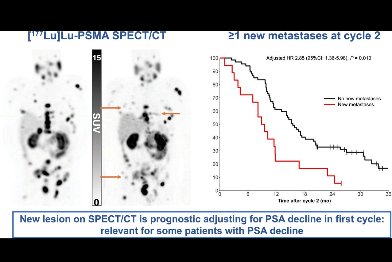 F1large fu Lb5 O Gw8 I Thumbnail