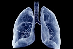 Lung Illustration Blue